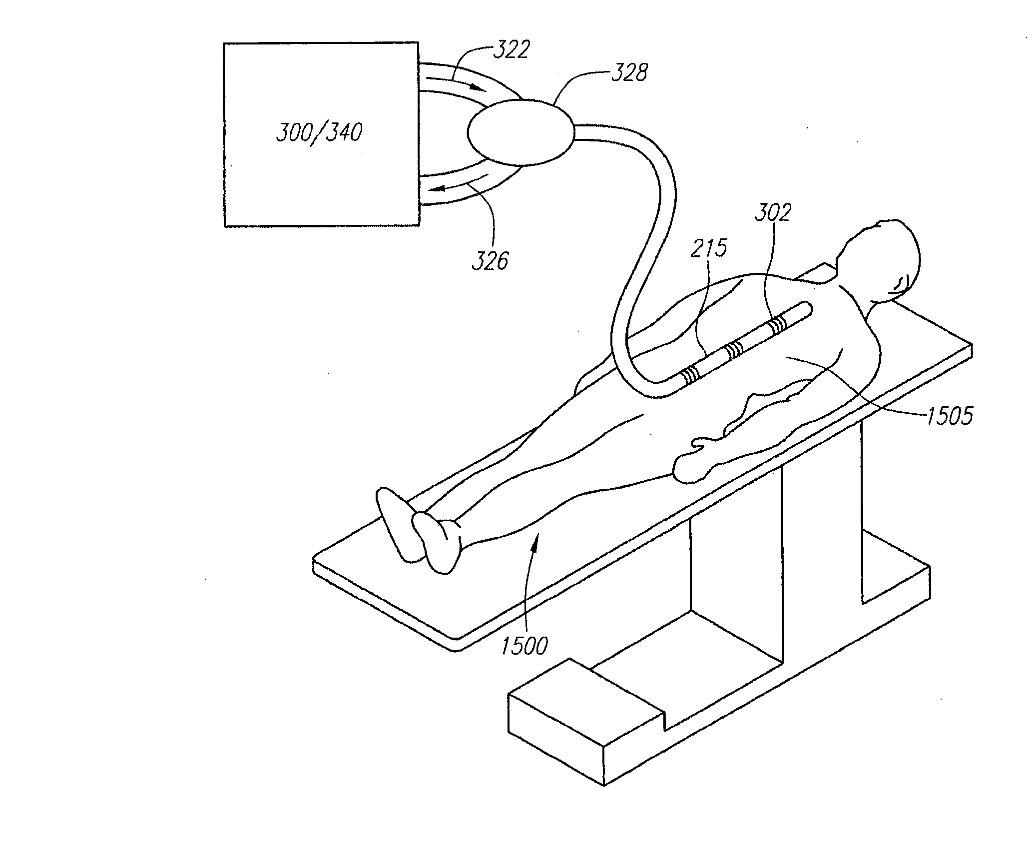 Optical fiber instrument system and method with motion-based adjustment