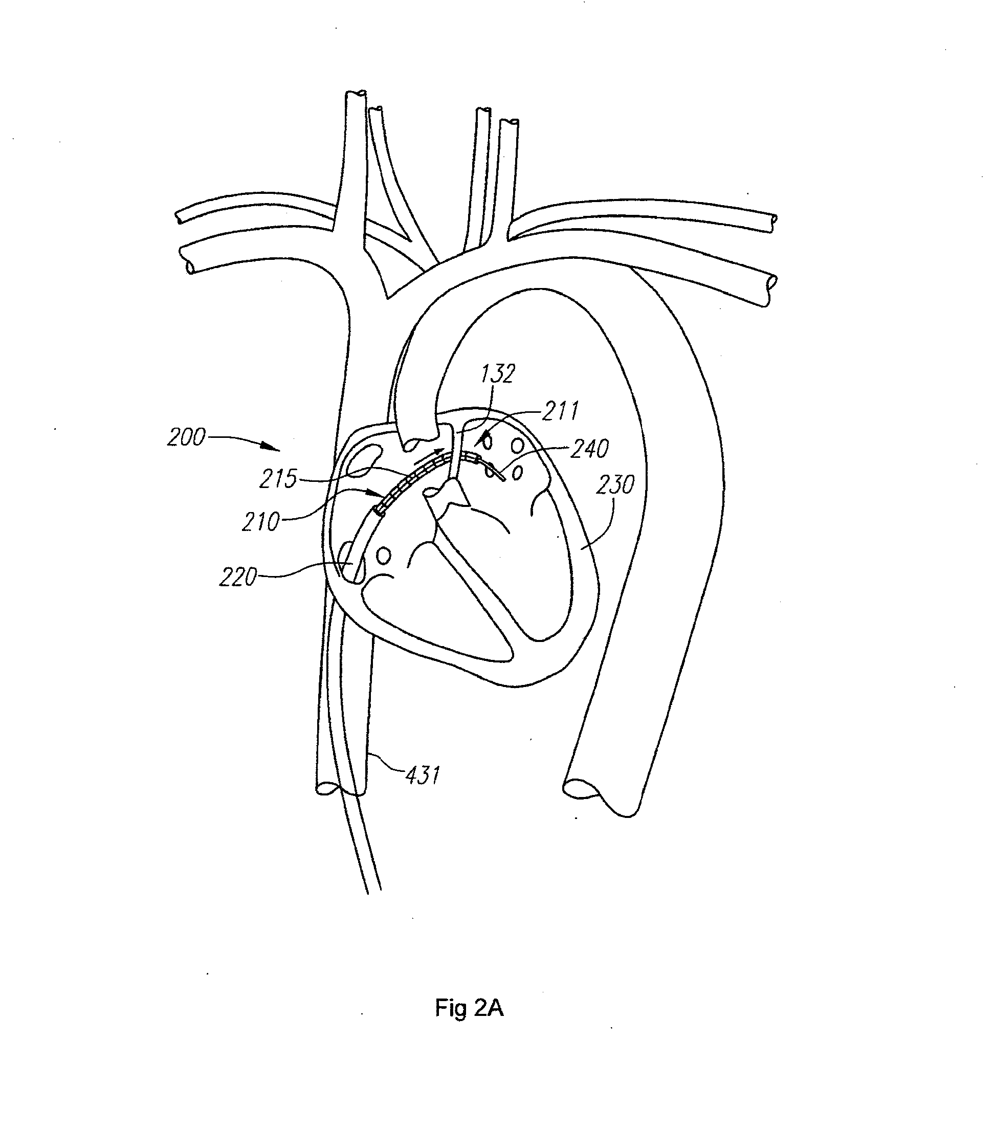 Optical fiber instrument system and method with motion-based adjustment