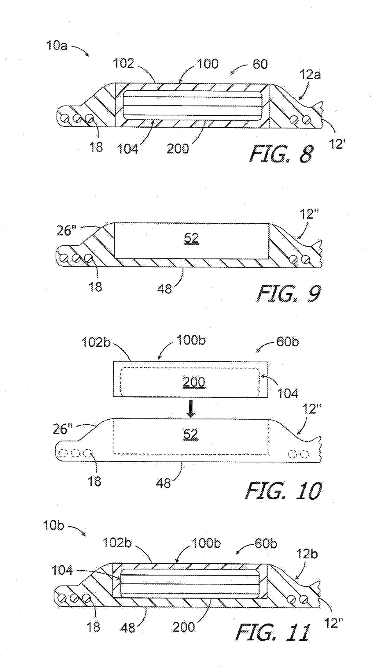 Magnet removal and replacement apparatus and methods for use with cochlear implants