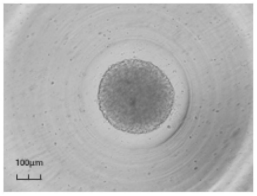 Culture medium special for organoids of nasopharyngeal carcinoma and scaffold-free culture method