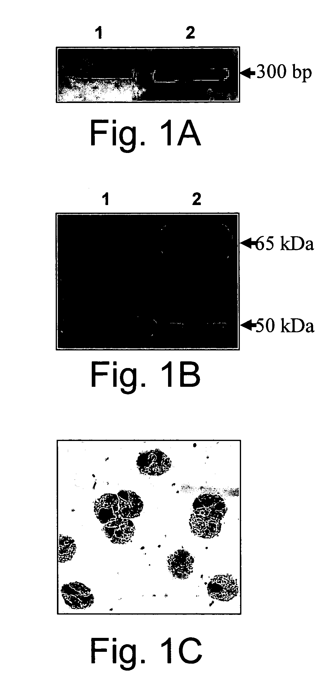 Eosinophil Major Basic Protein as a natural heparanase-inhibiting protein, compositions, methods and uses thereof