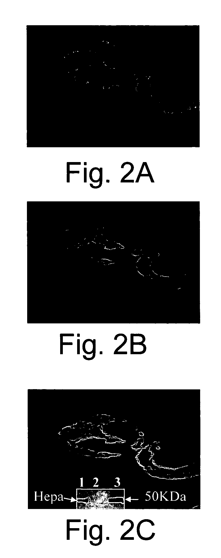 Eosinophil Major Basic Protein as a natural heparanase-inhibiting protein, compositions, methods and uses thereof