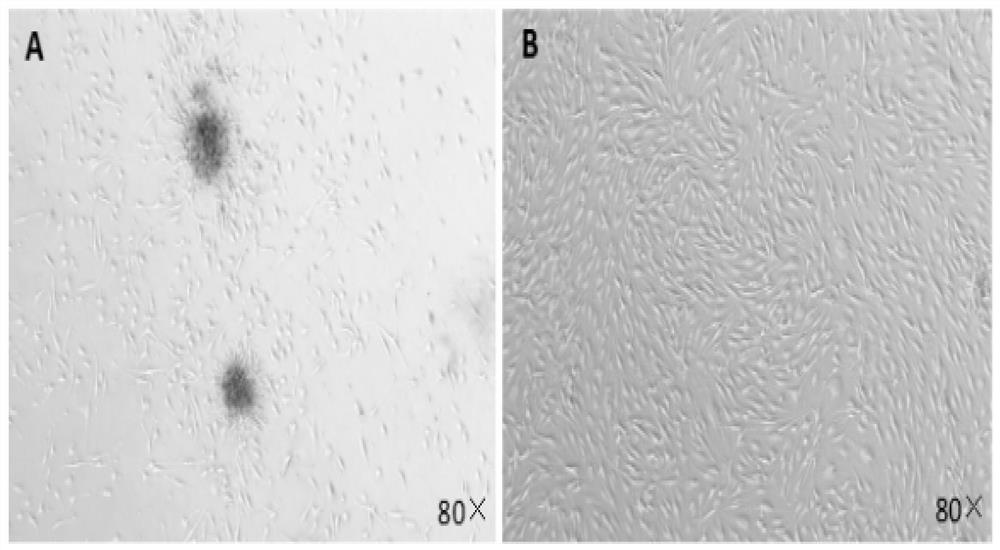 A soft tissue construction method and application of synovial mesenchymal stem cells