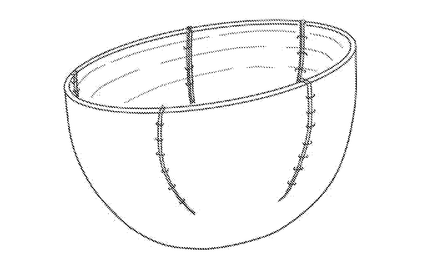 Breast Prosthesis Support Device Based on Tissue Matrix Material, and Preparation Method Therefor