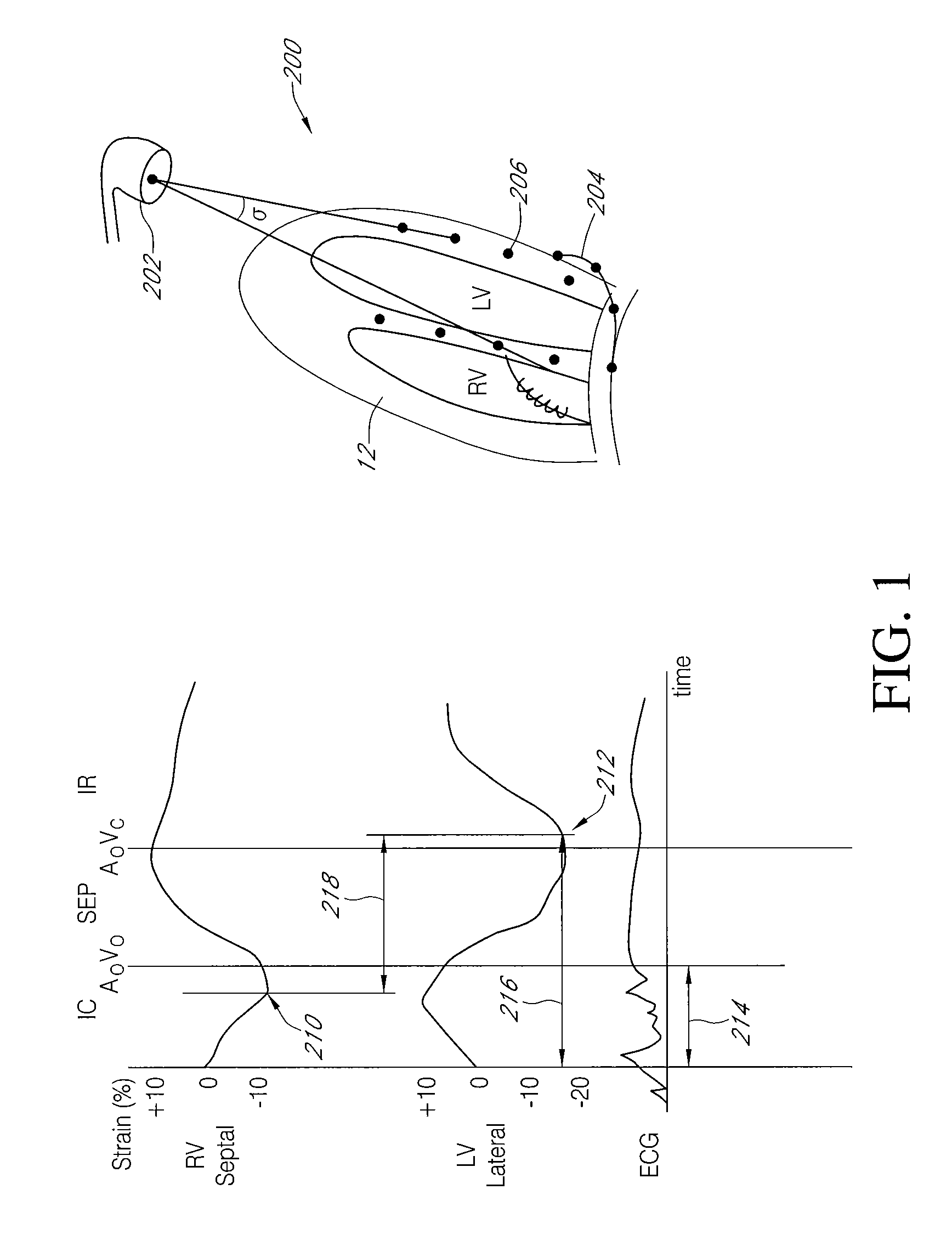 Matrix optimization method of individually adapting therapy in an implantable cardiac therapy device