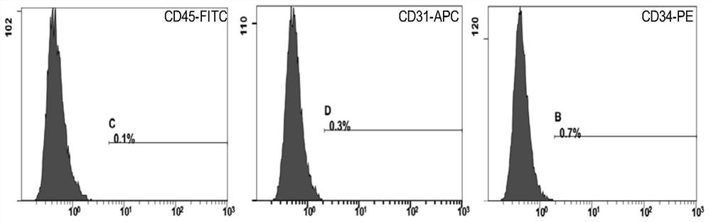 Therapeutic application of human amniotic epithelial cells in autoimmune diseases