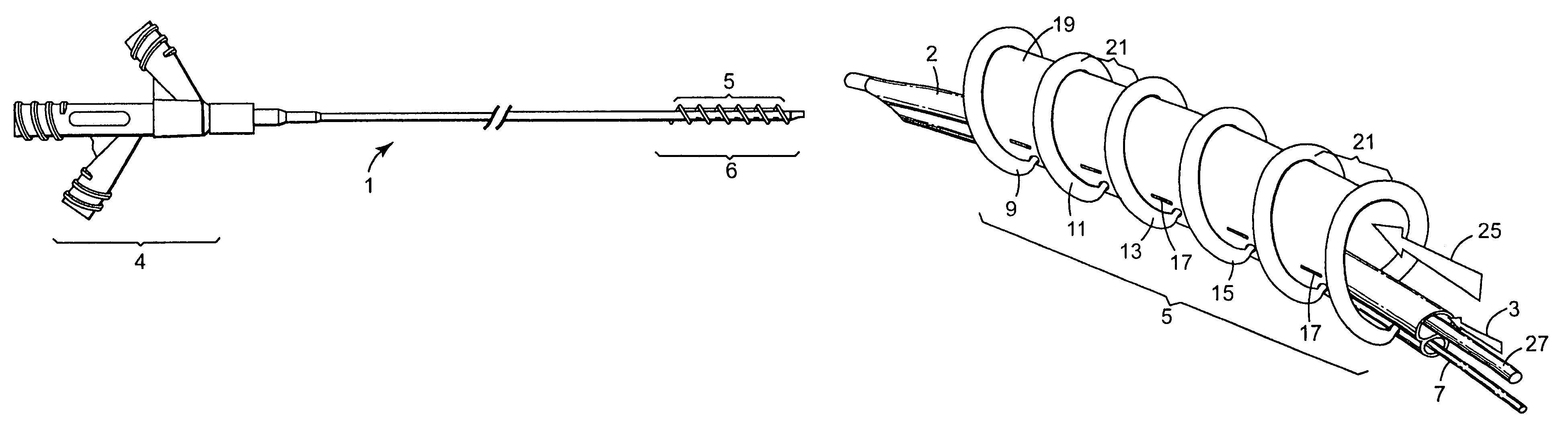 Valve treatment catheter and methods