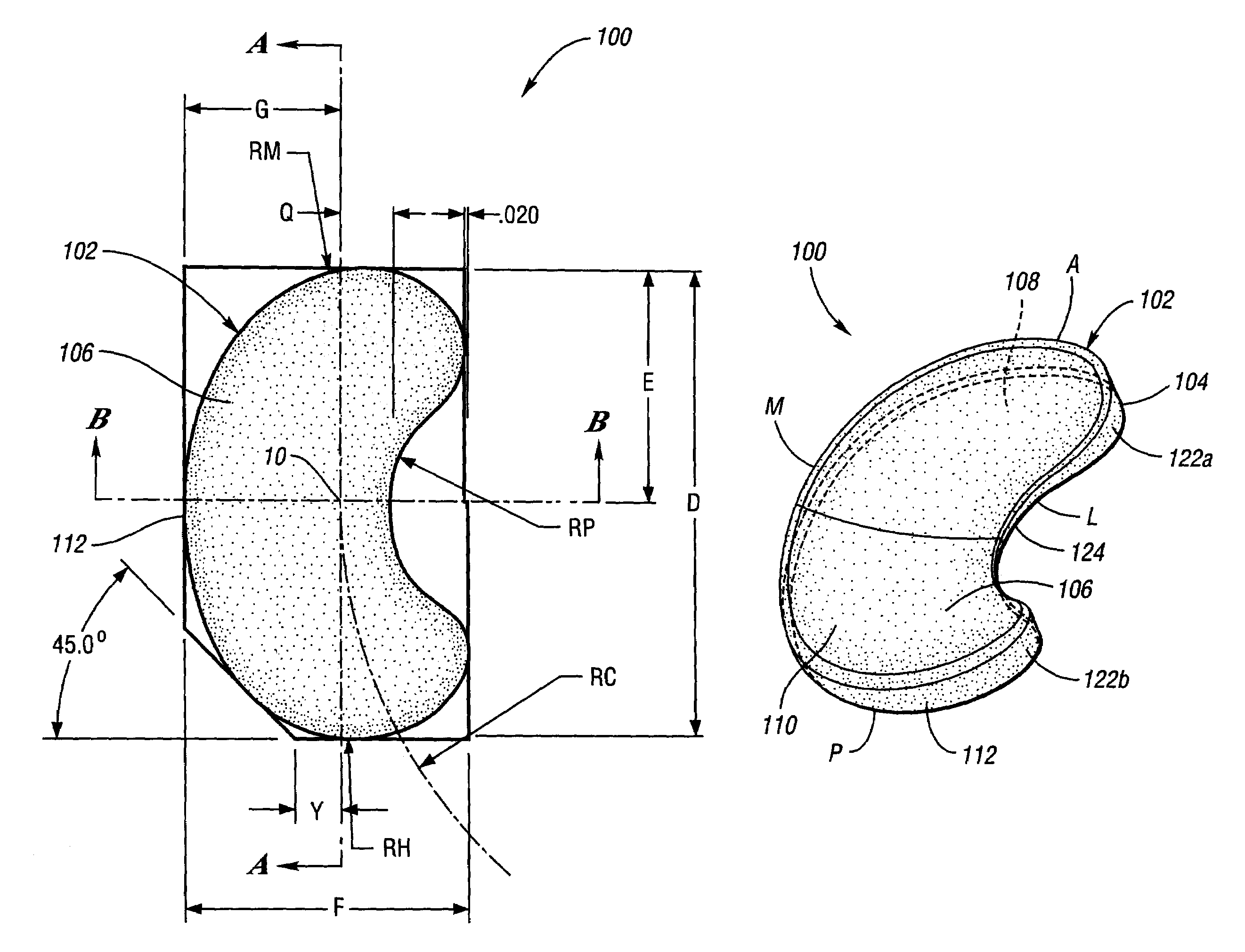 Proportioned surgically implantable knee prosthesis