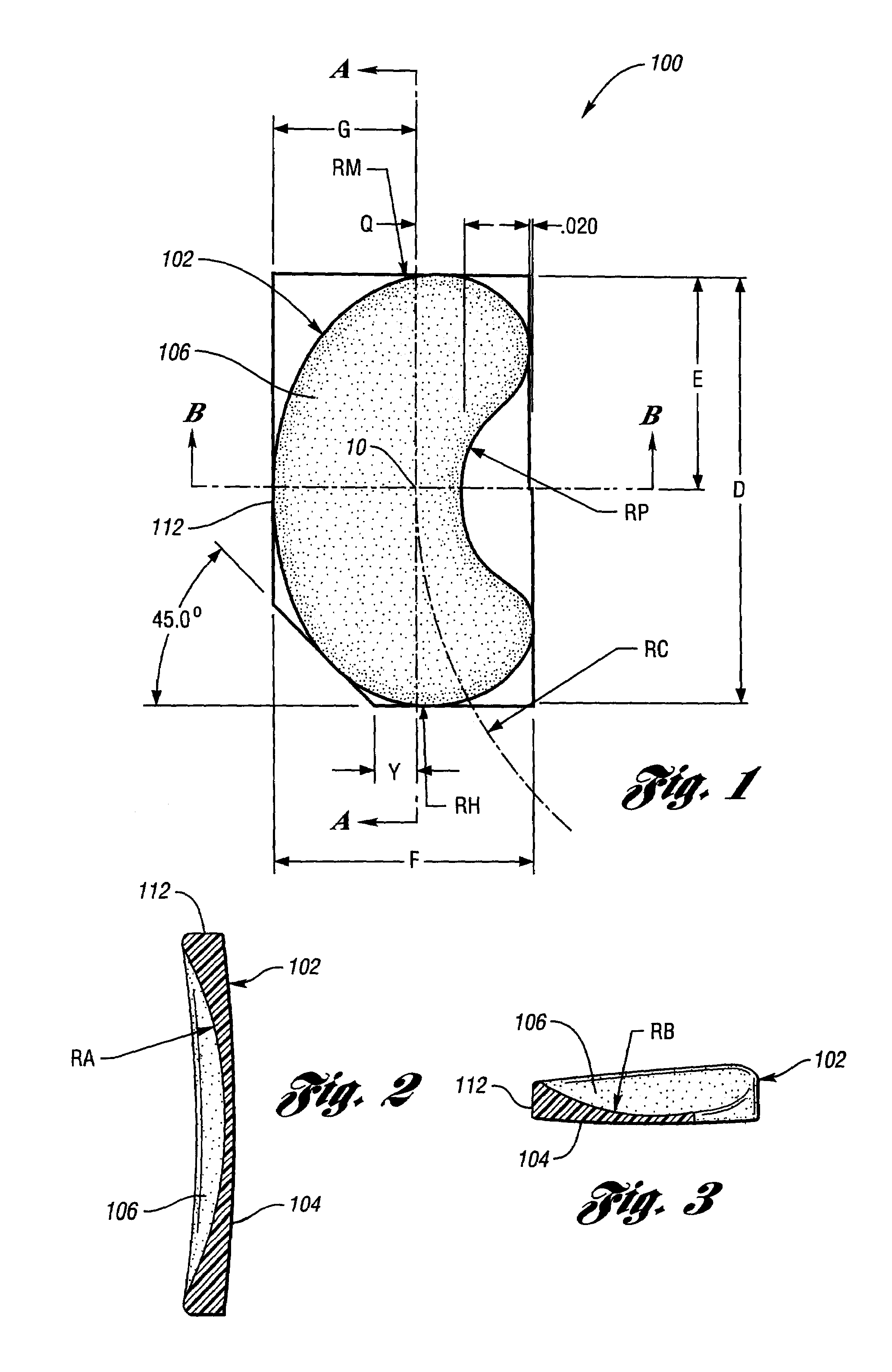 Proportioned surgically implantable knee prosthesis