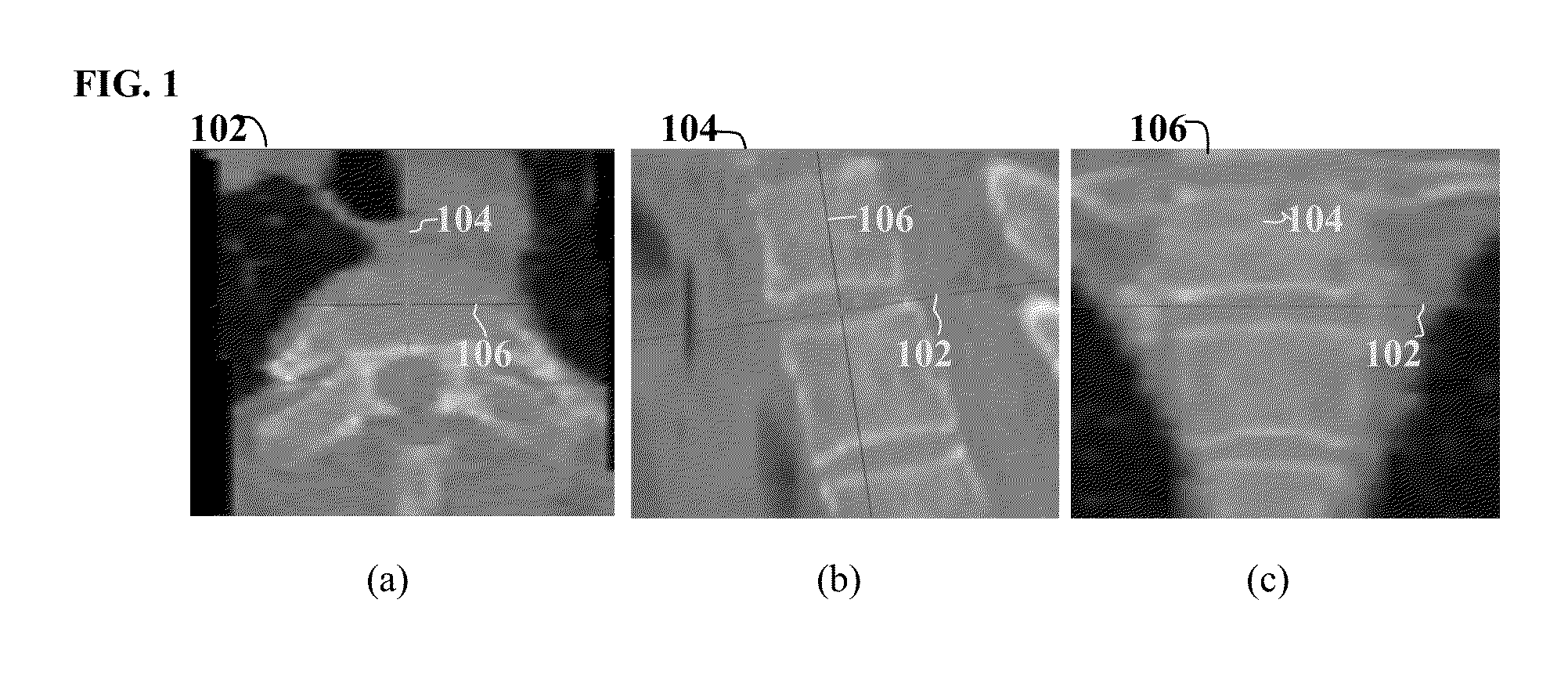 Method and System for On-Site Learning of Landmark Detection Models for End User-Specific Diagnostic Medical Image Reading