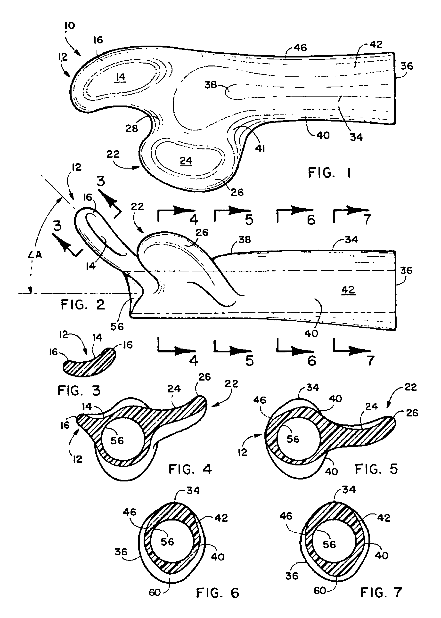 Ergonomic handgrip with separate ulnar and radial support means