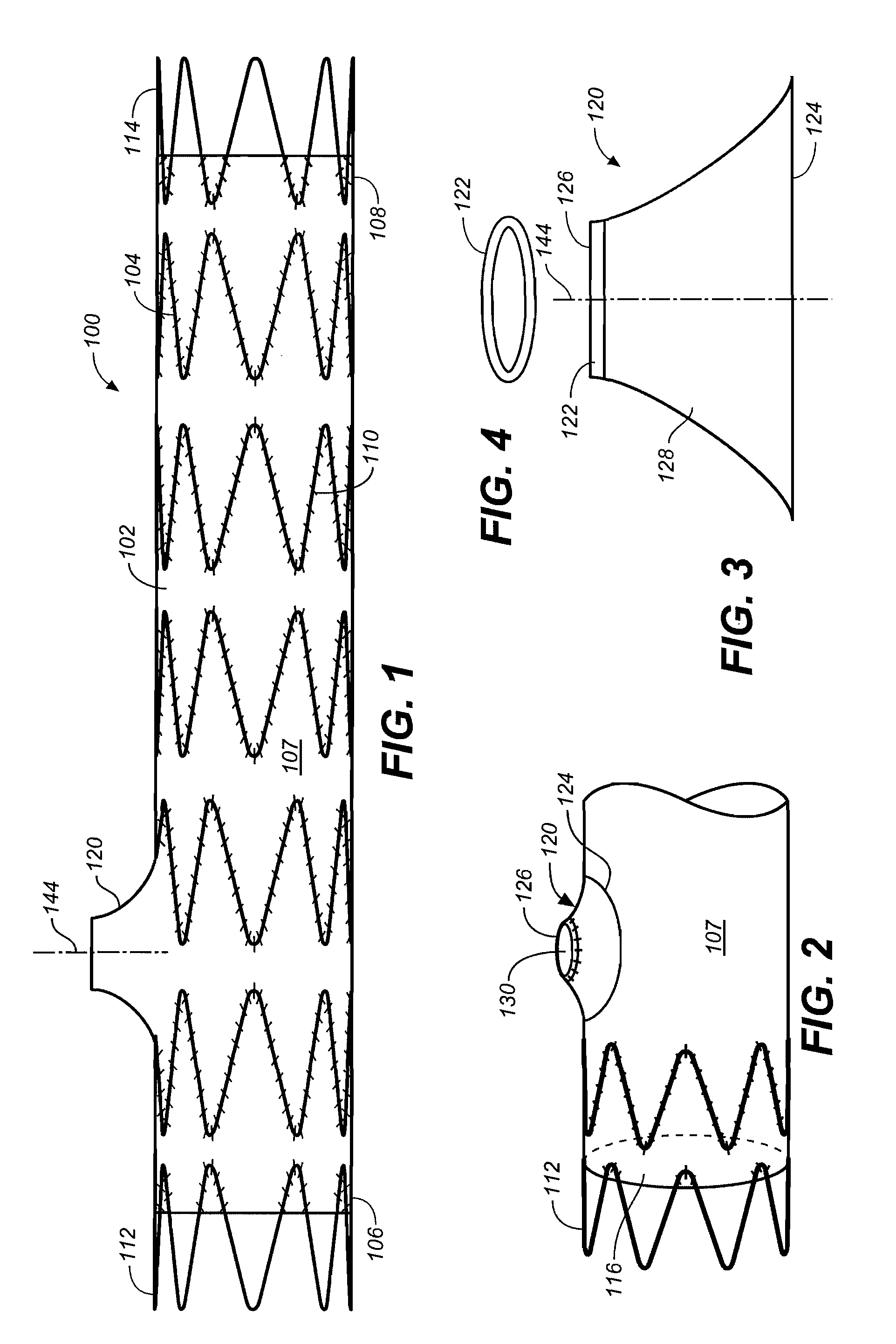 Mobile external coupling with internal sealing cuff for branch vessel connection