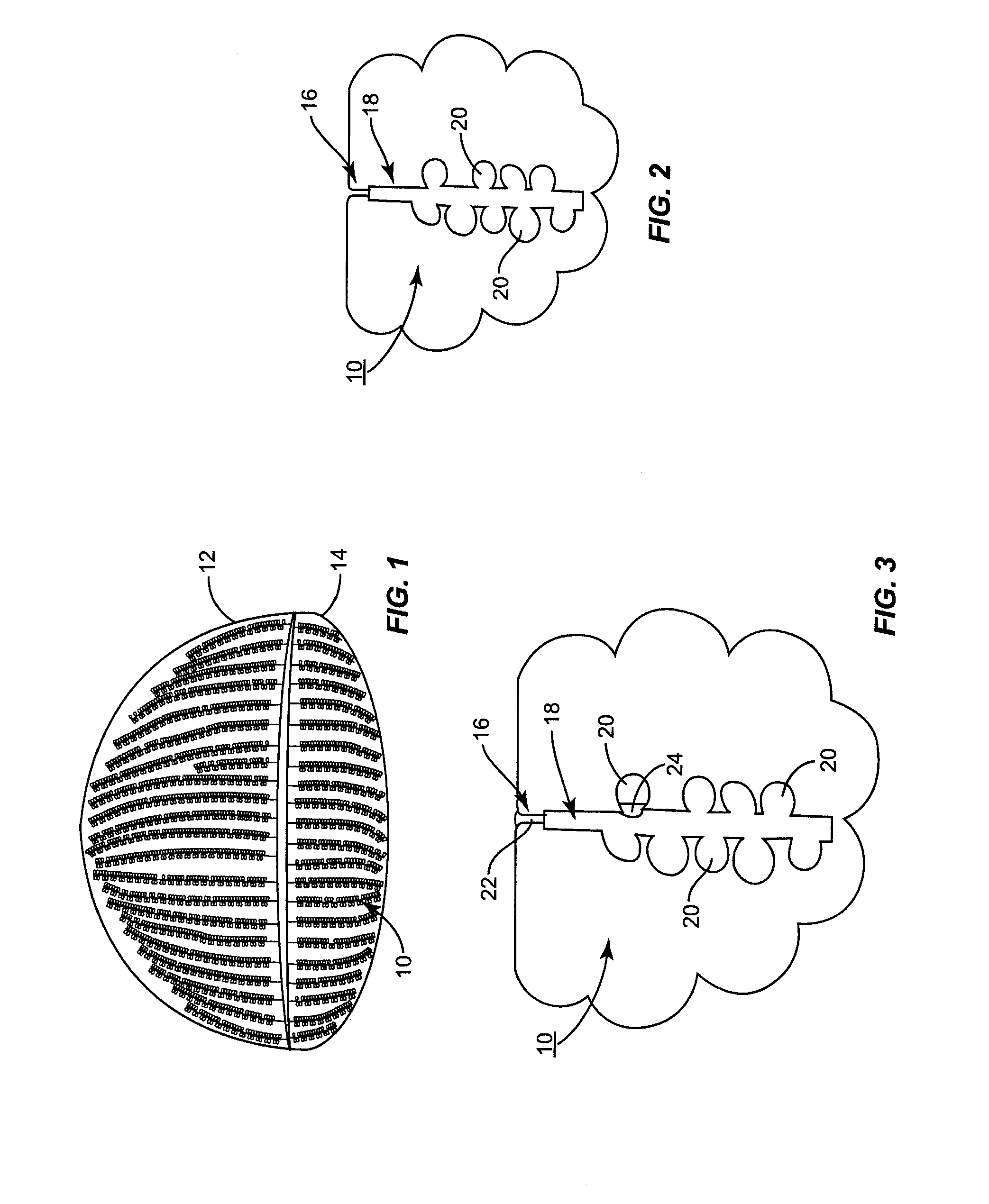 System for inner eyelid heat and pressure treatment for treating meibomian gland dysfunction