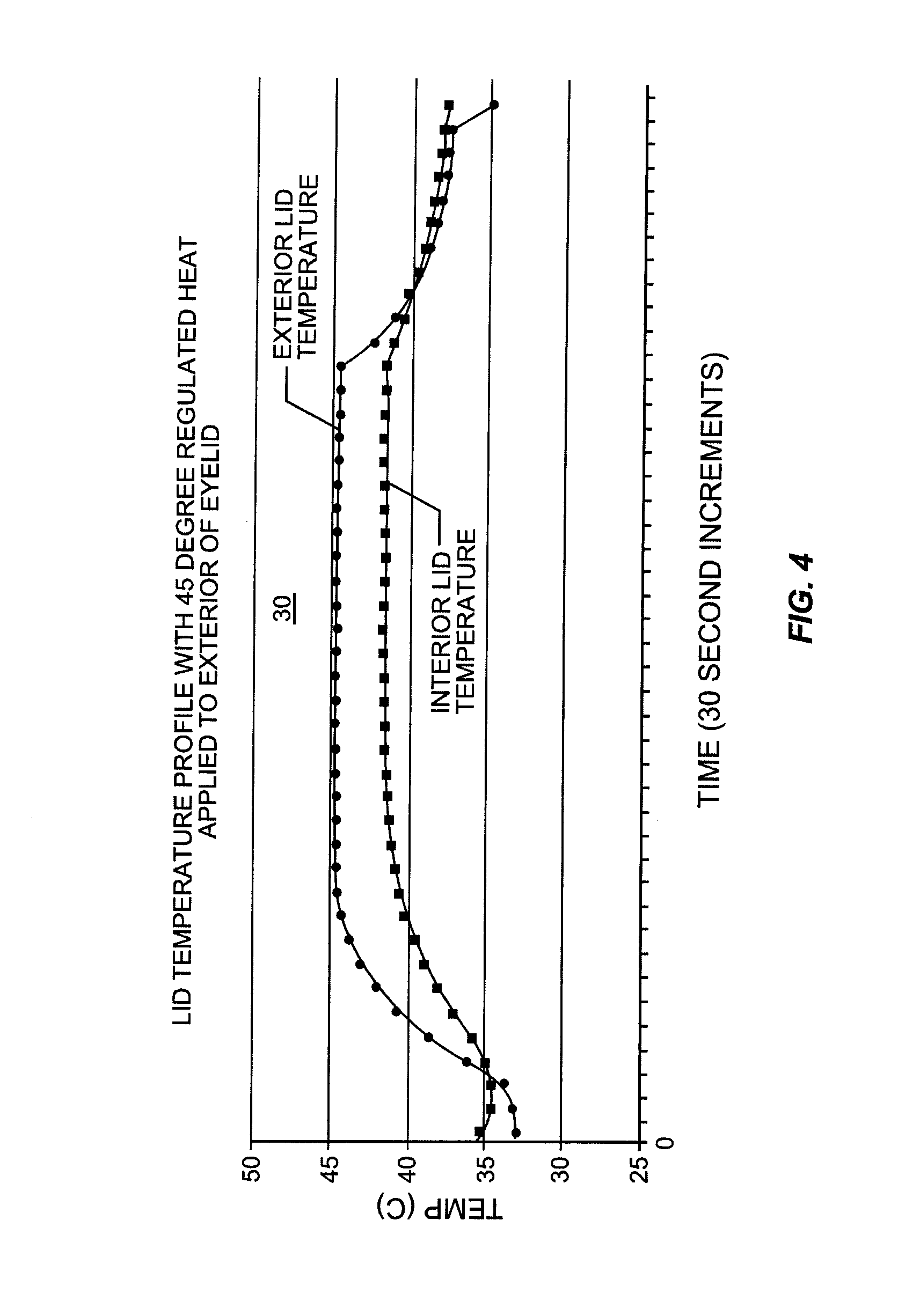 System for inner eyelid heat and pressure treatment for treating meibomian gland dysfunction