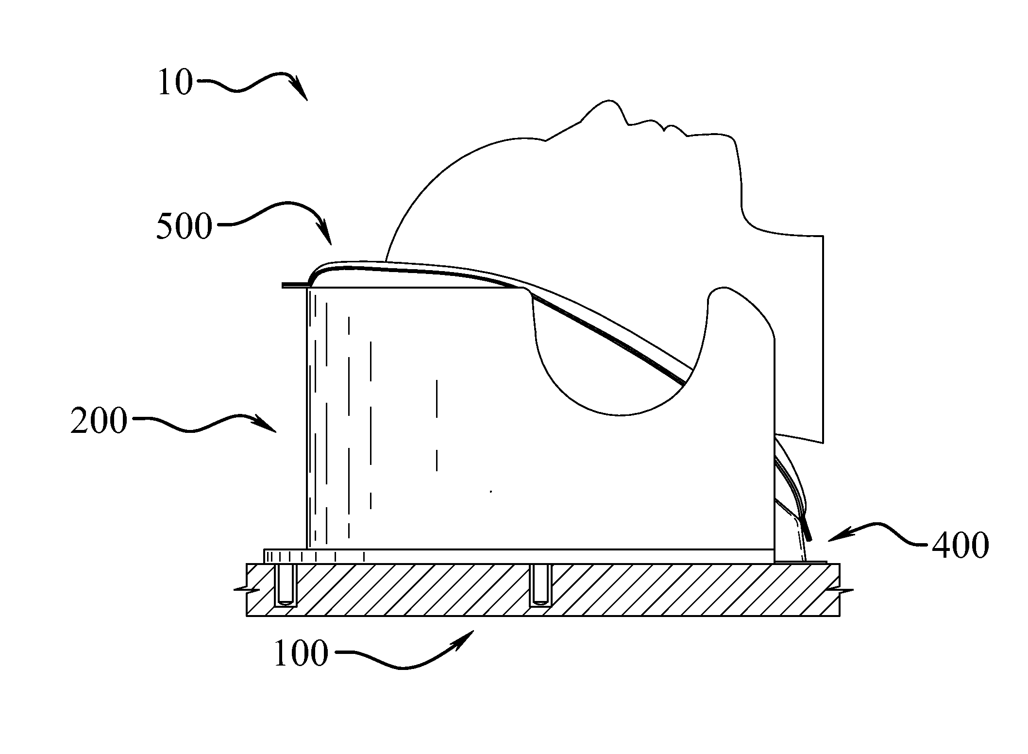 Immobilization system