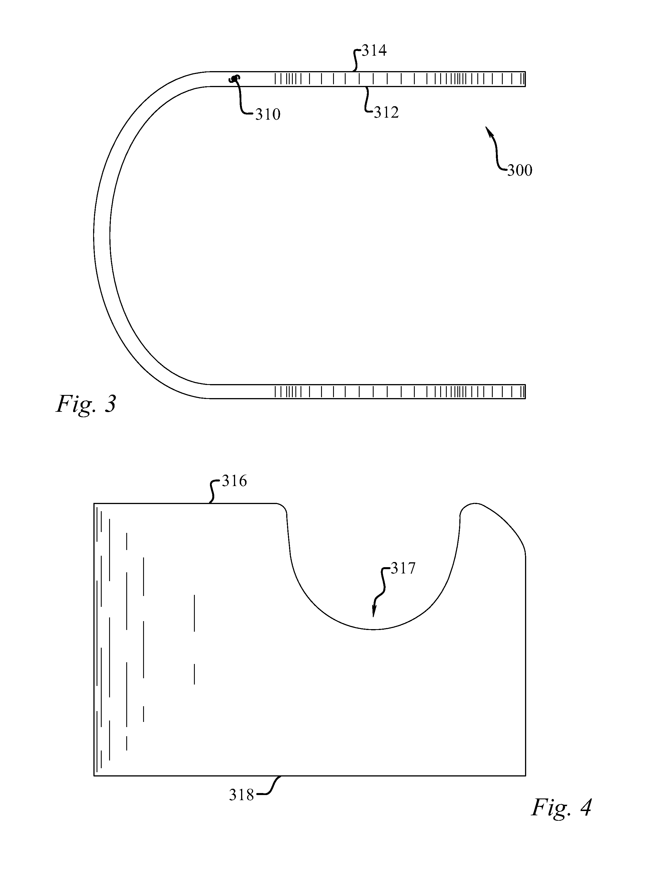 Immobilization system