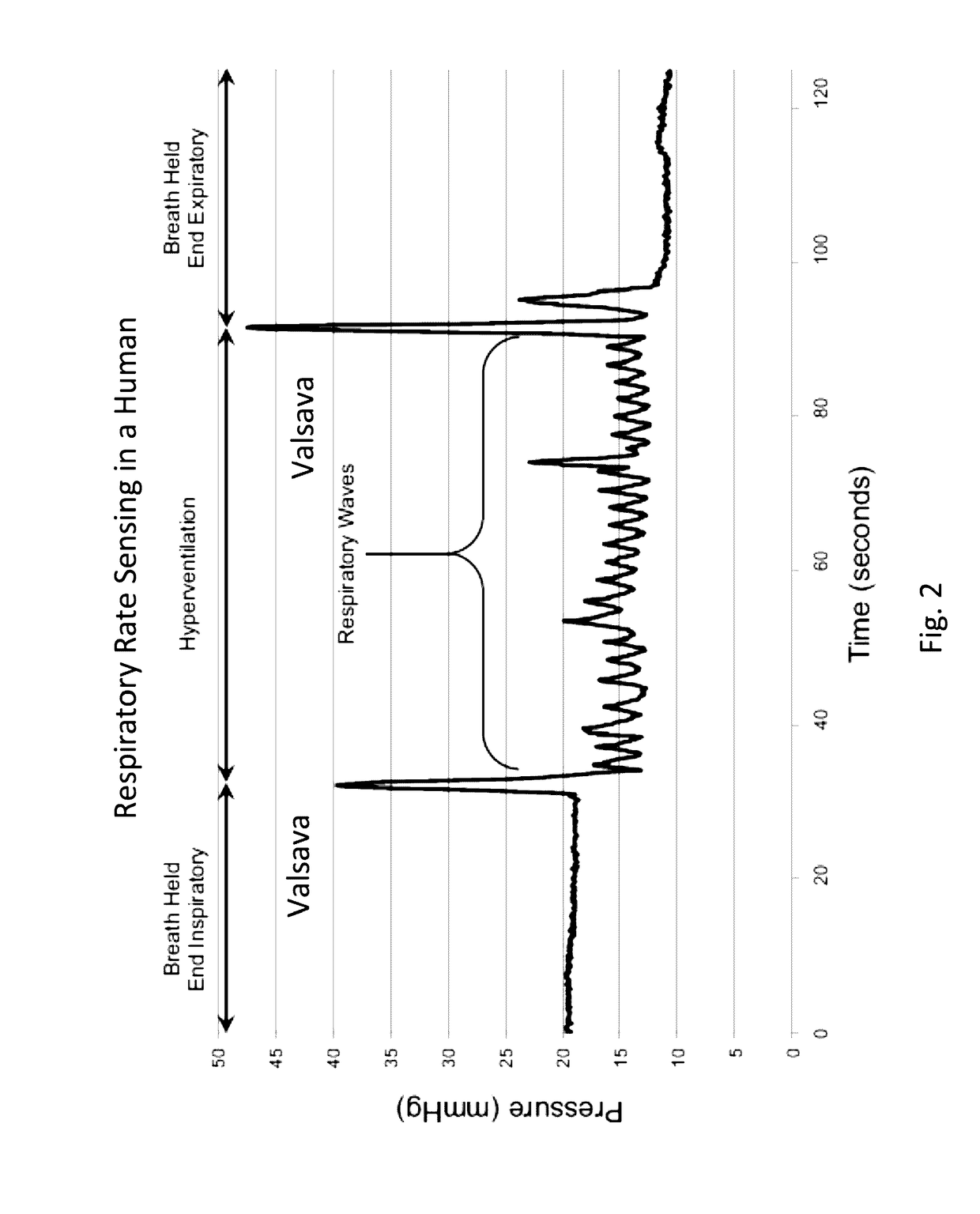 Systems, devices and methods for draining and analyzing bodily fluids