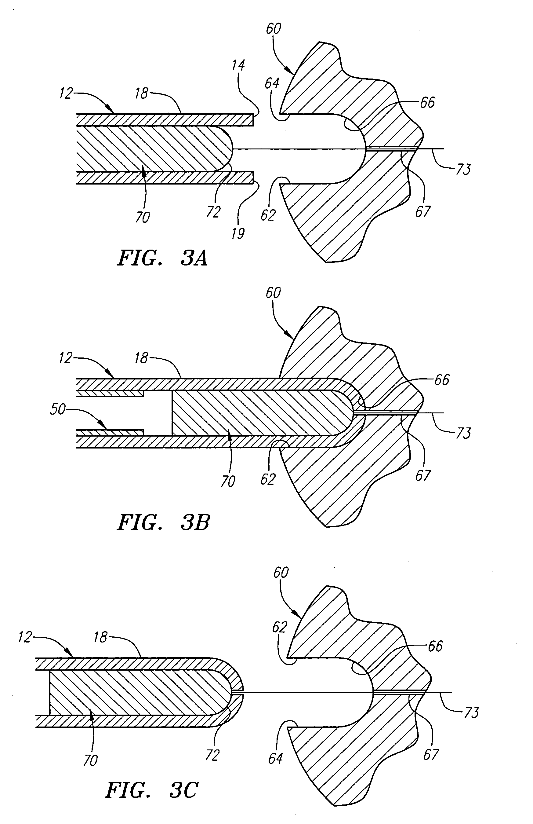 Apparatus for delivering endoluminal prostheses and methods of making and using them