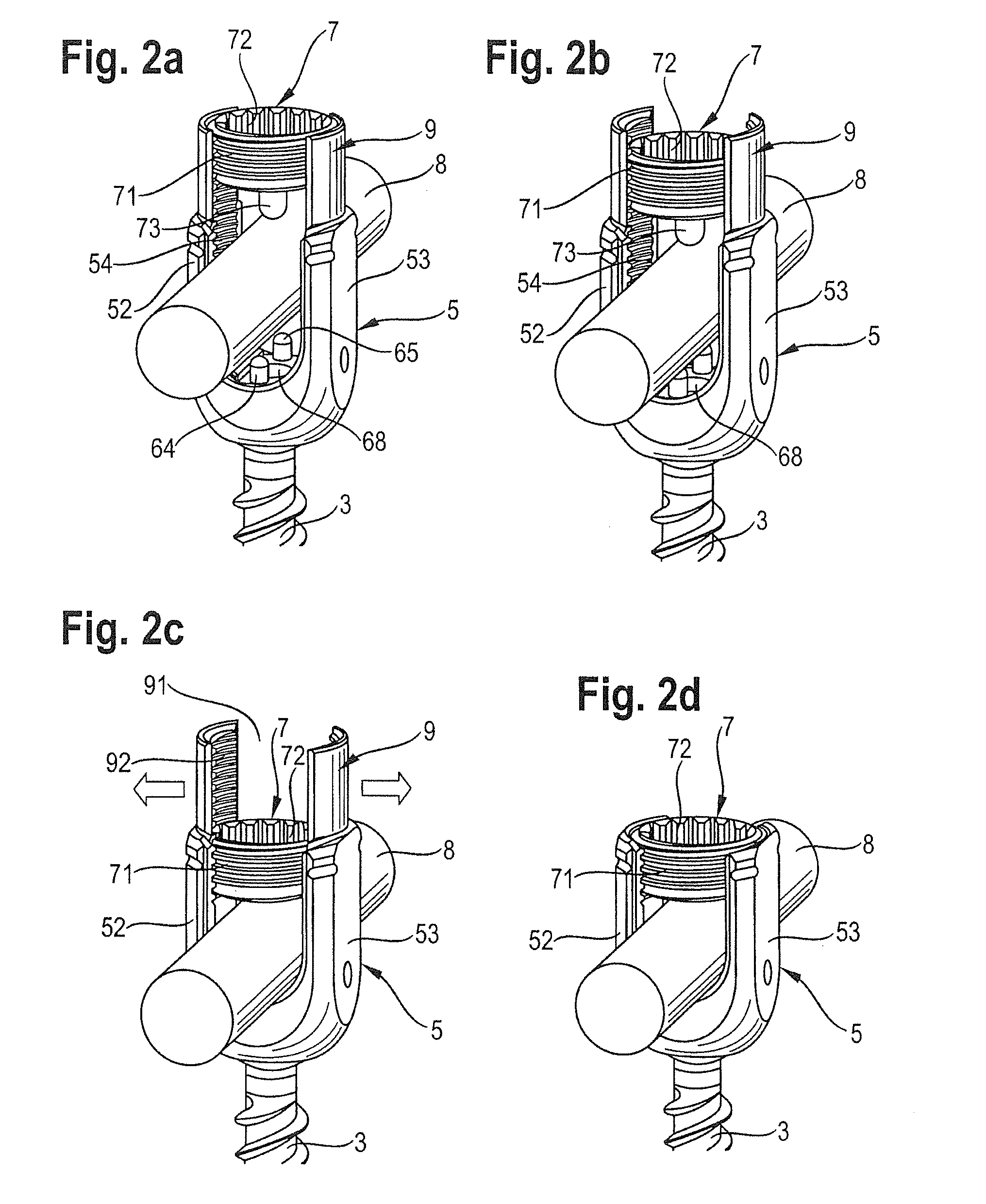 Bone anchoring assembly