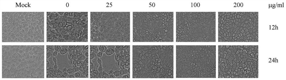 Medicine, disinfectant and additive for resisting porcine pseudorabies virus and using method of medicine, disinfectant and additive