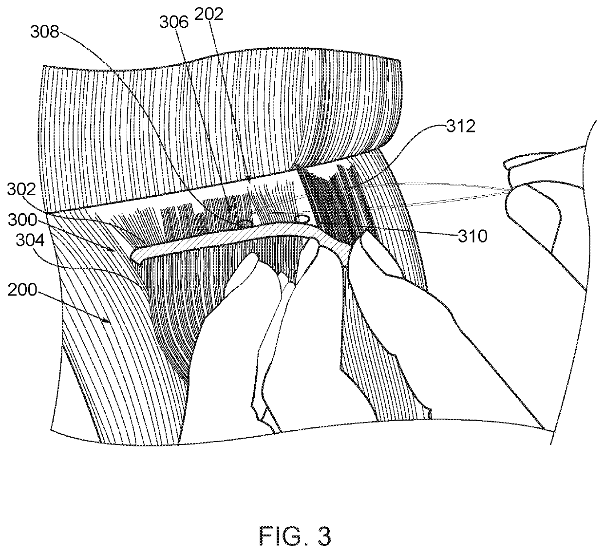 Method for applying a weft hair extension with concealed beads