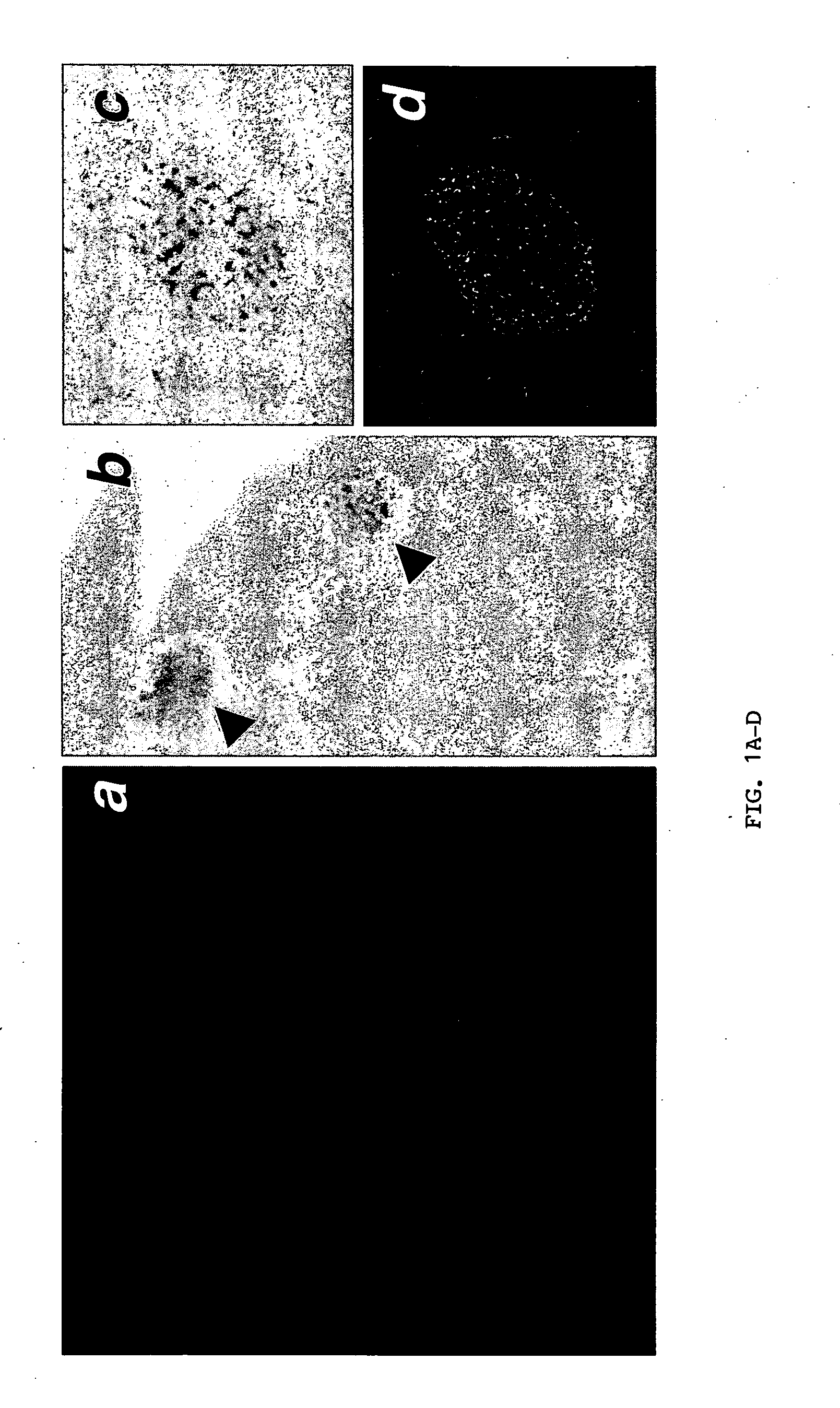 Methods for improving pancreatic islet cell transplantation