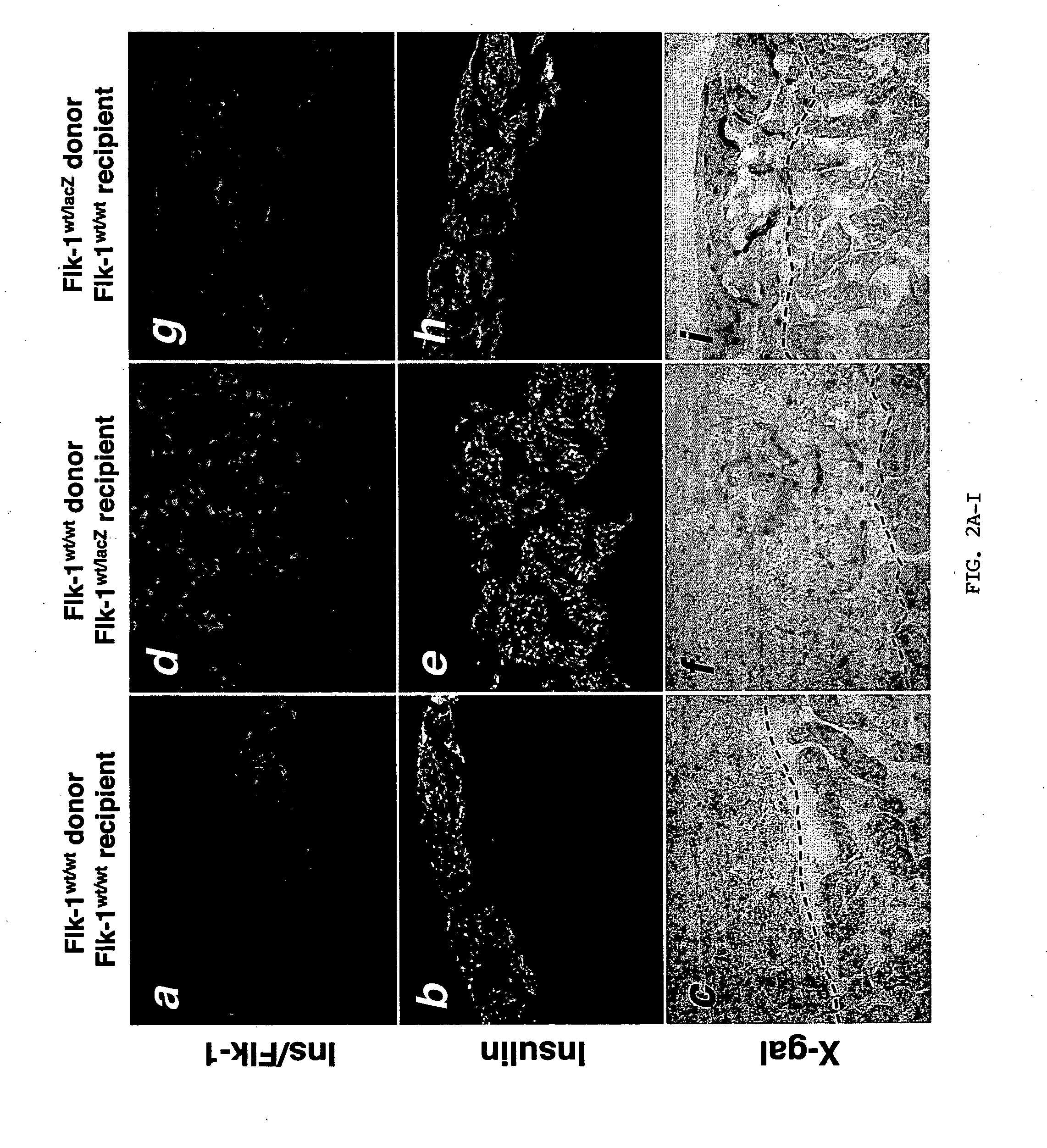 Methods for improving pancreatic islet cell transplantation