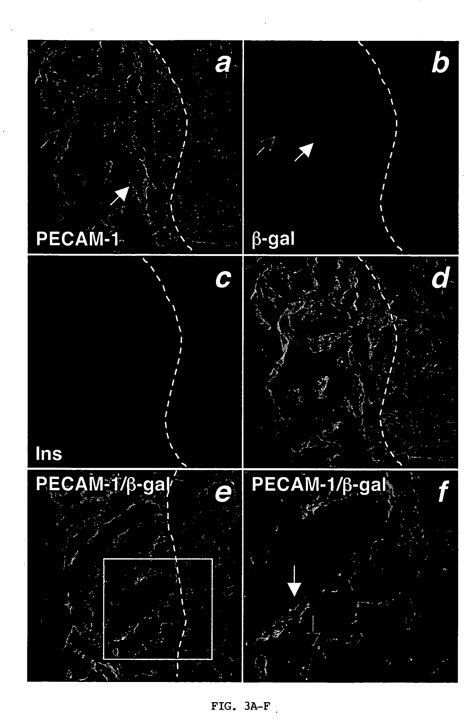 Methods for improving pancreatic islet cell transplantation