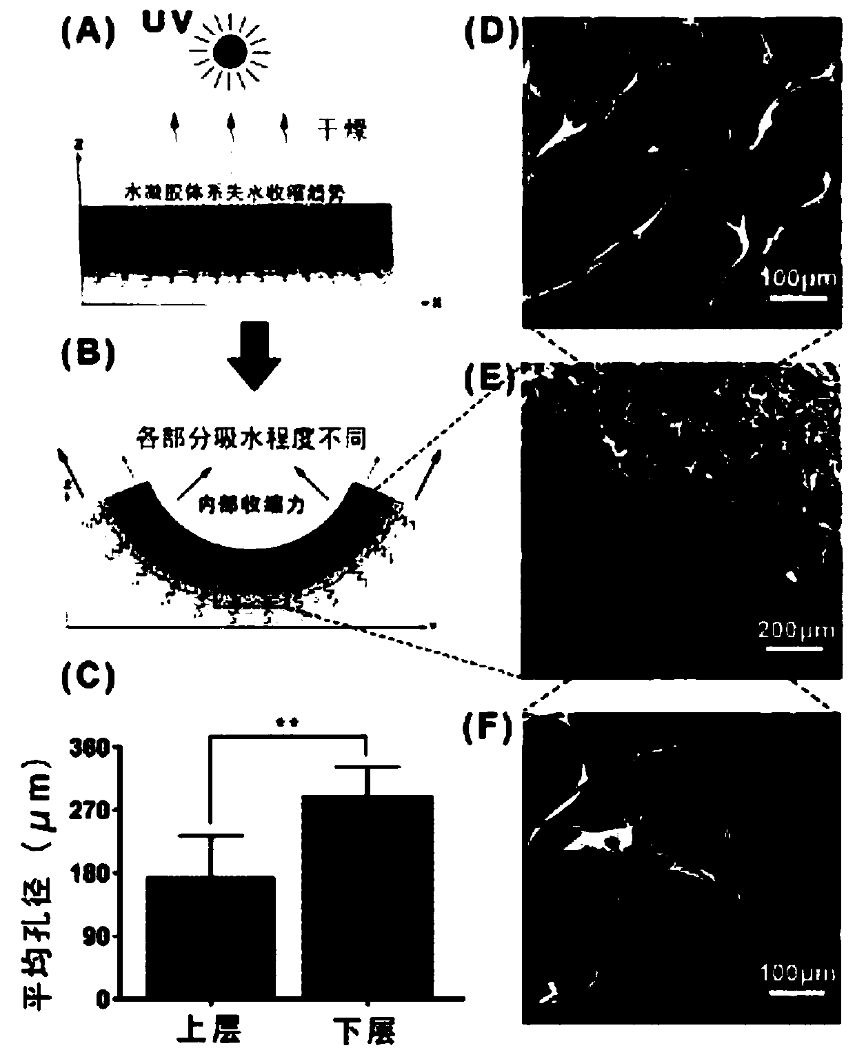 Hydrogel vascular micro stent and preparation method thereof