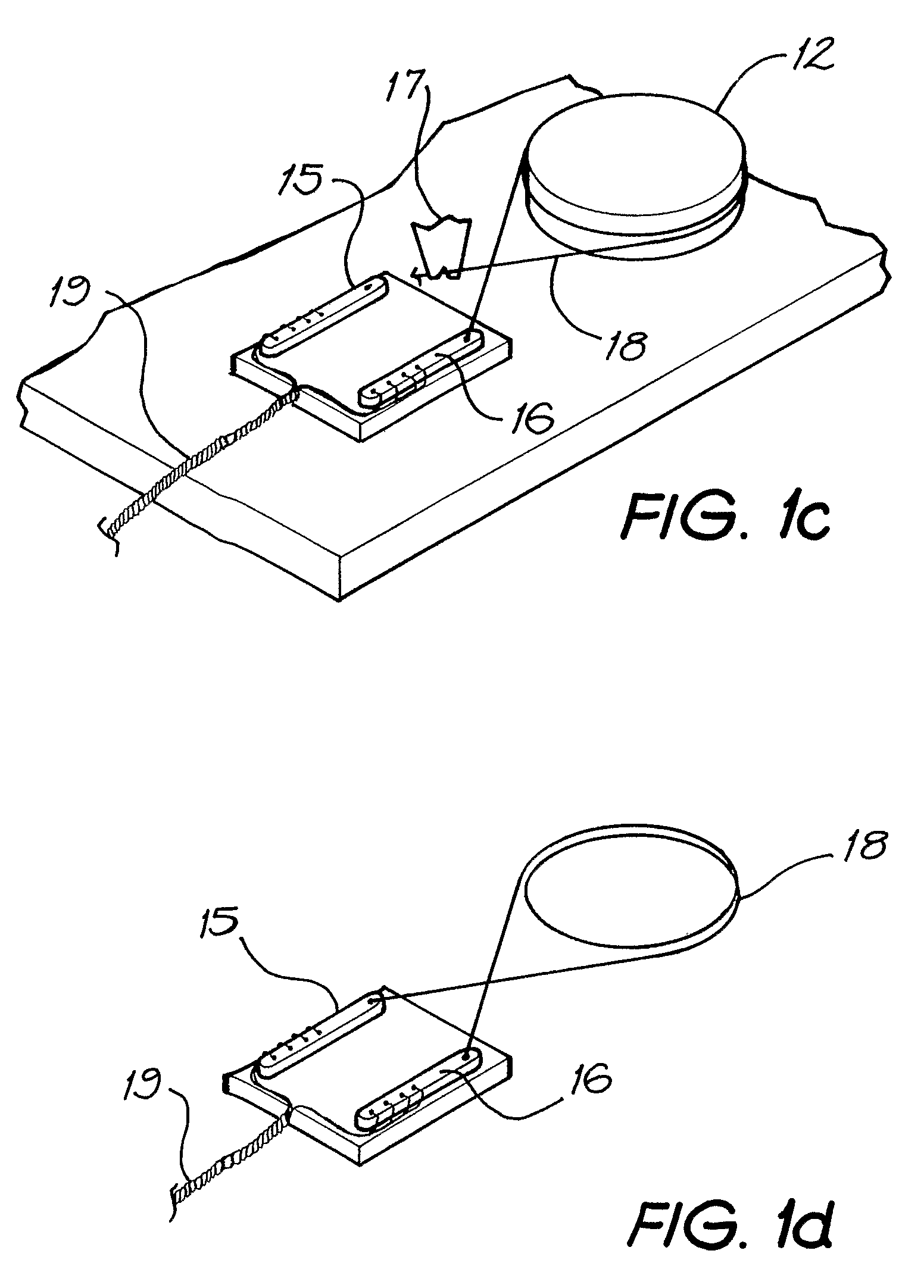 Implantable antenna