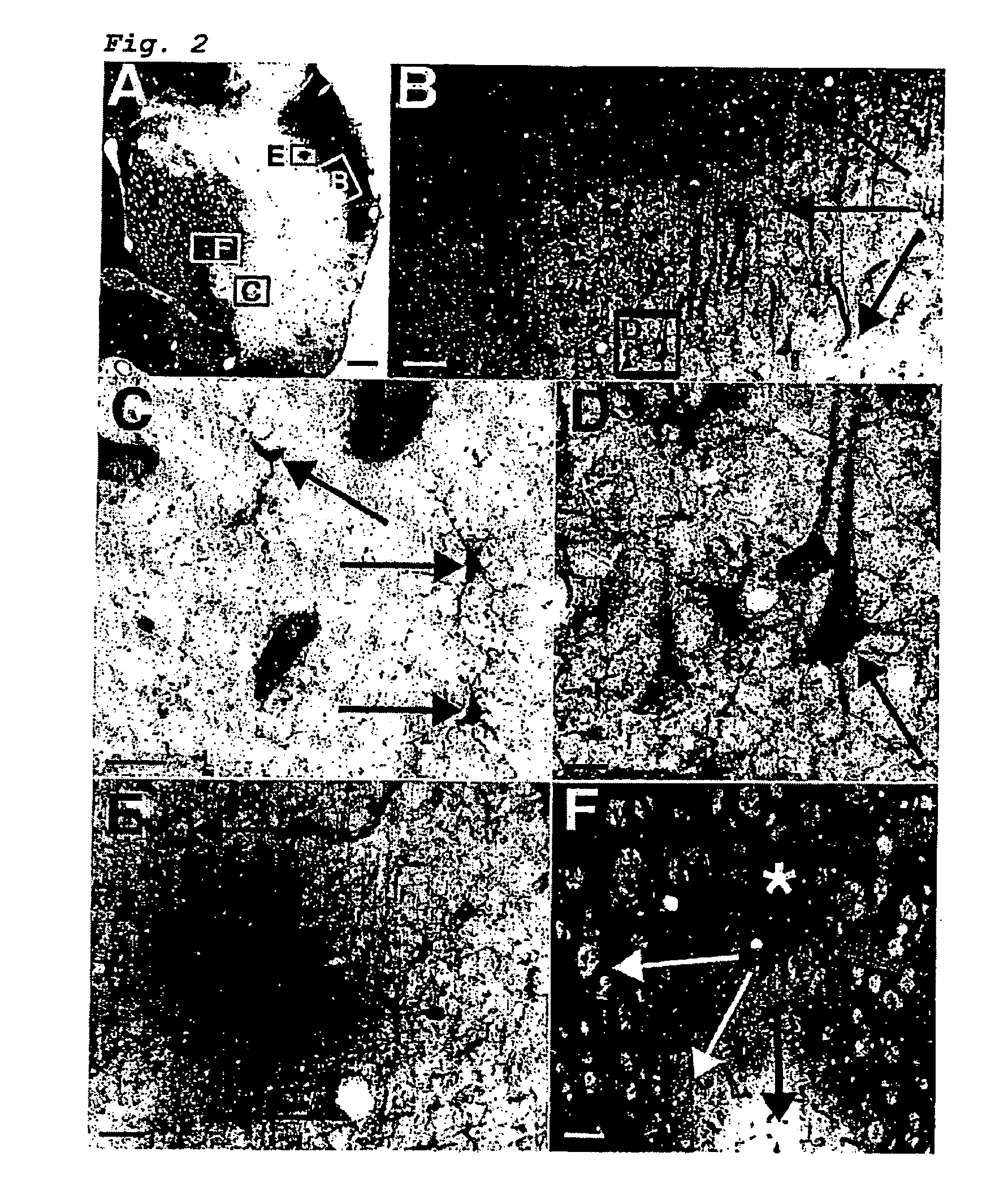 Diagnostic substance and method for the analysis of metabolism processes in the brain