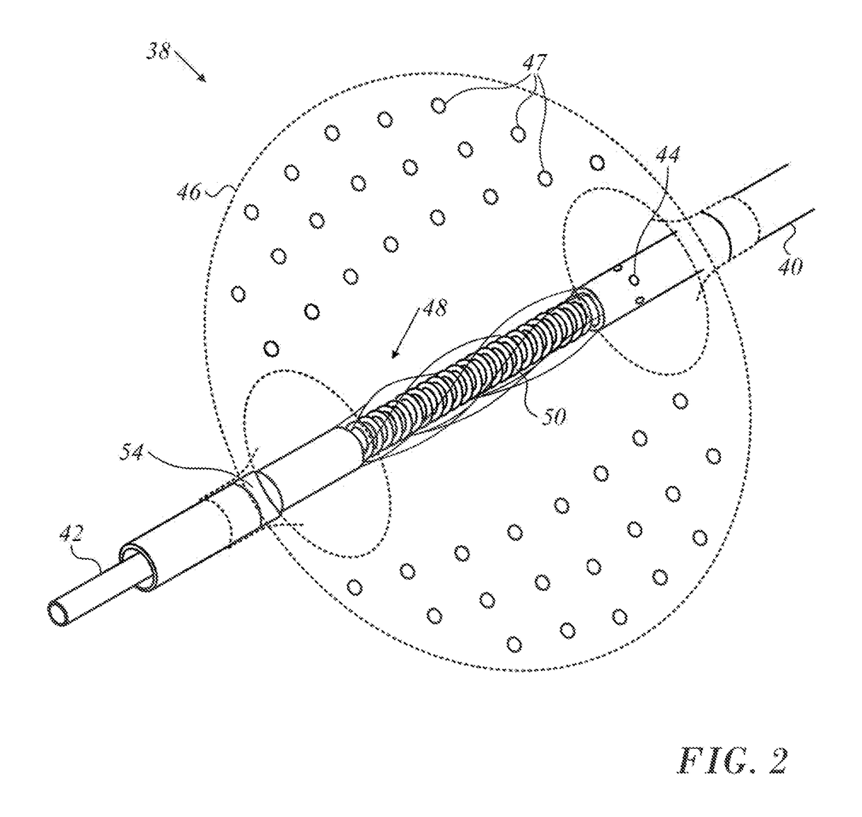 Spring-loaded balloon