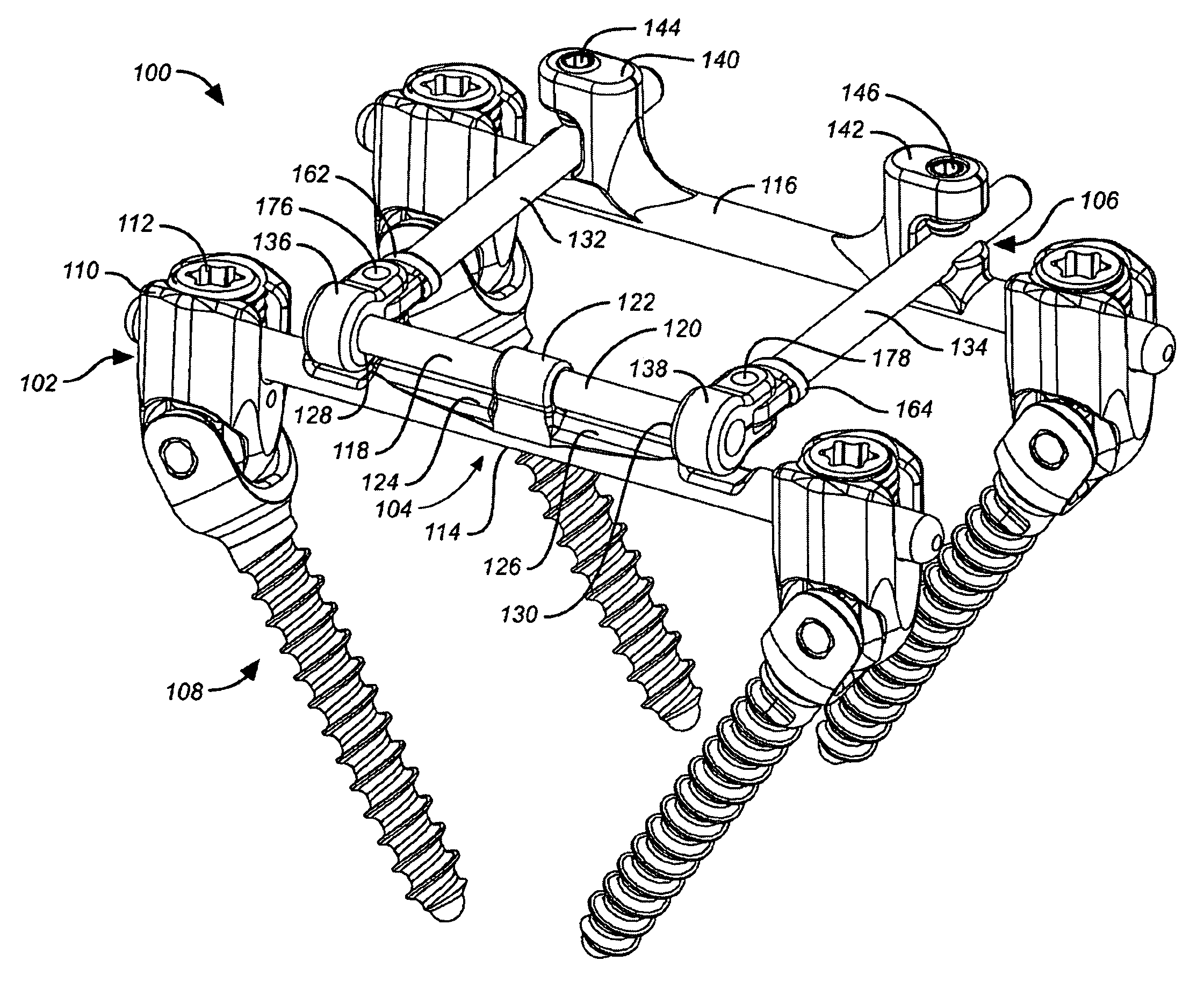 Method for implanting a deflection rod system and customizing the deflection rod system for a particular patient need for dynamic stabilization and motion preservation spinal implantation system