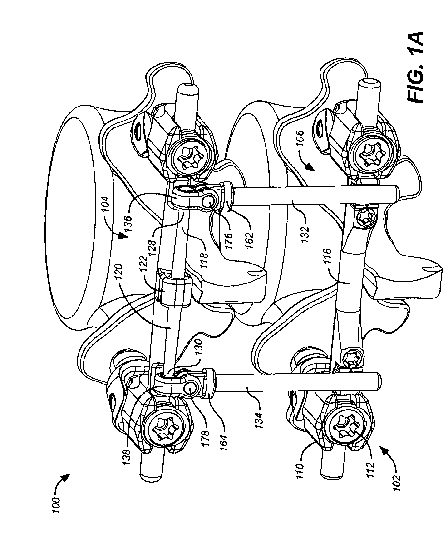 Method for implanting a deflection rod system and customizing the deflection rod system for a particular patient need for dynamic stabilization and motion preservation spinal implantation system