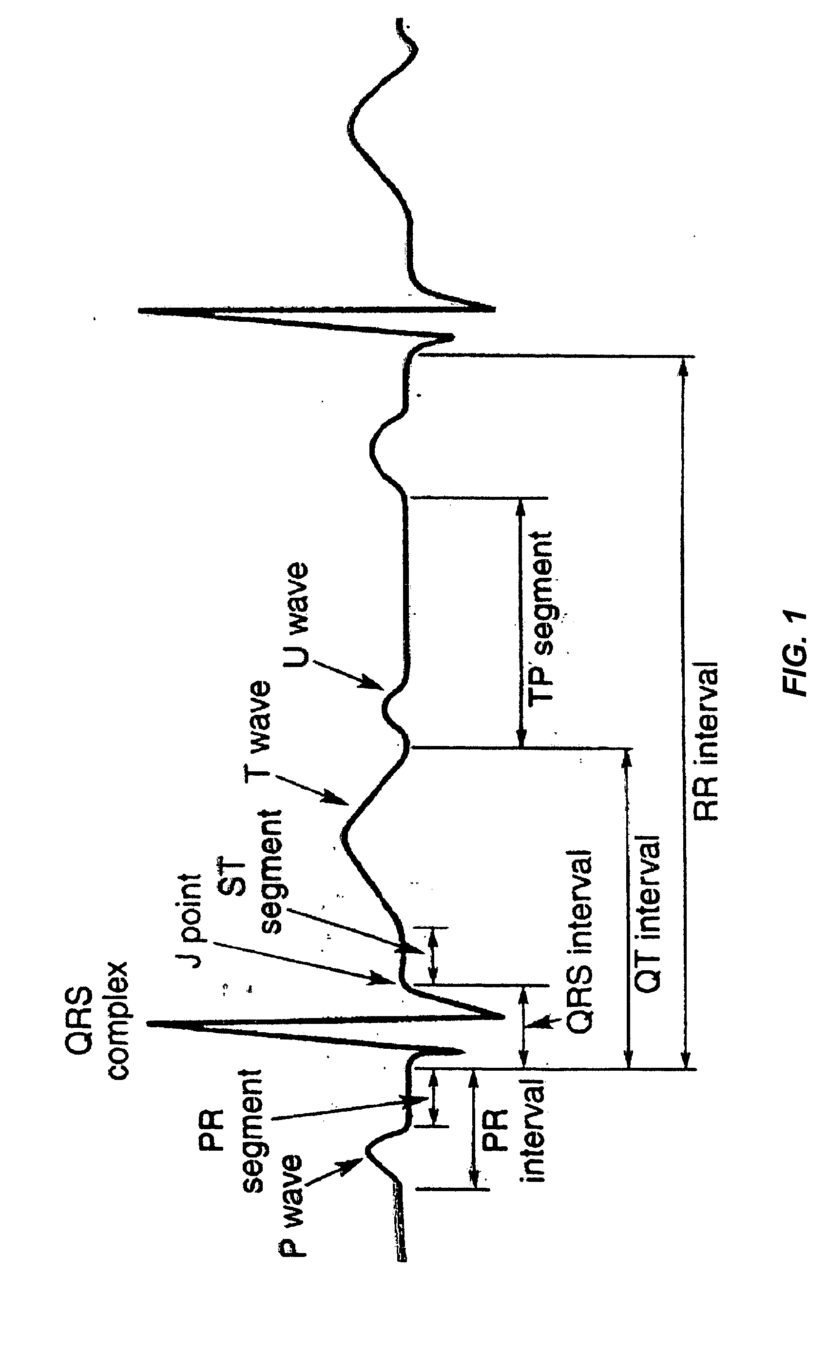 Method and apparatus for transfer of captured electrocardiogram data