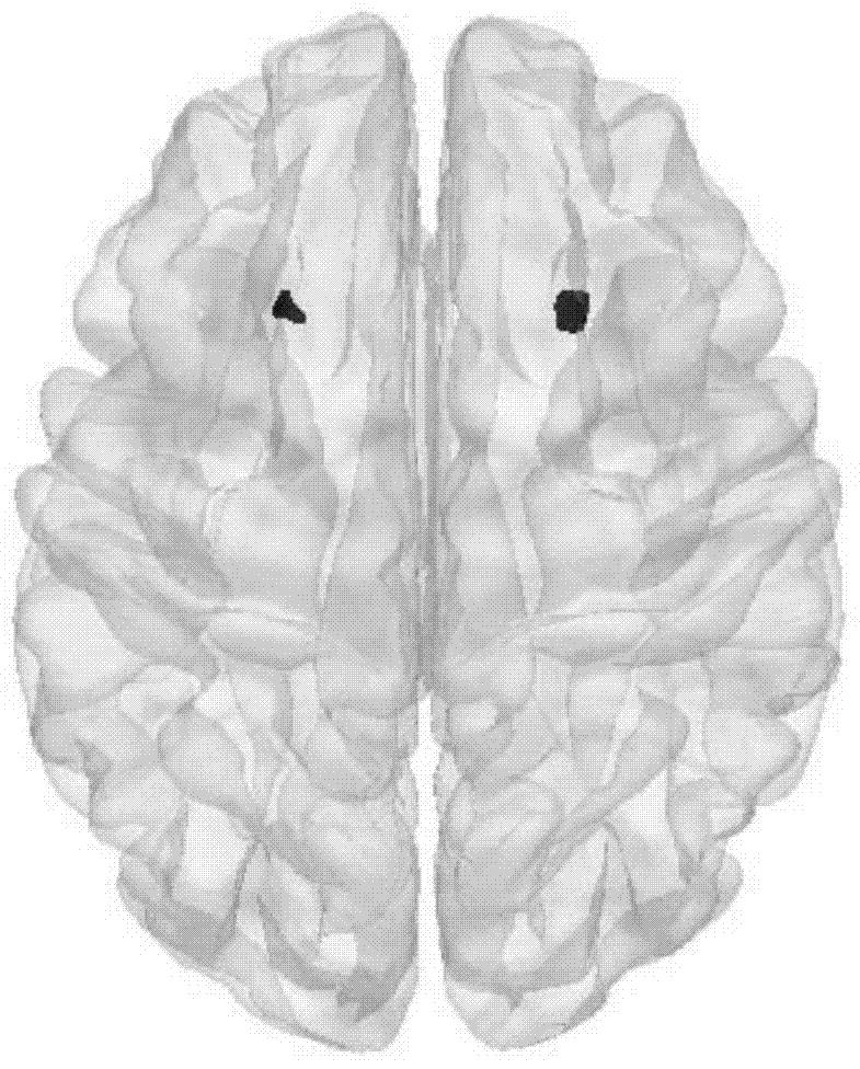 Method for automatically segmenting human lateral geniculate nucleus (LGN) by using prior knowledge