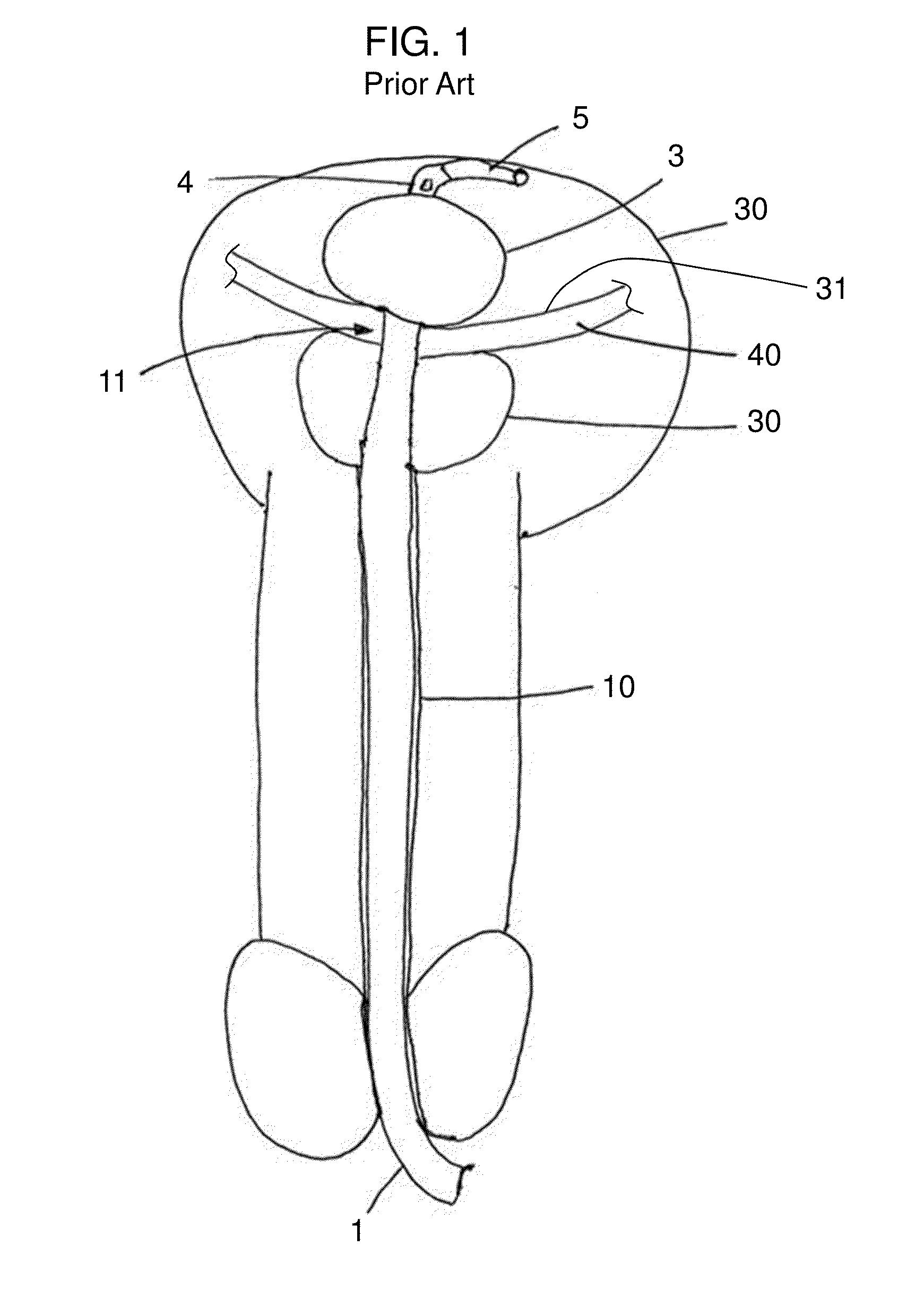 Stretch Valve Balloon Catheter and Methods for Producing and Using Same