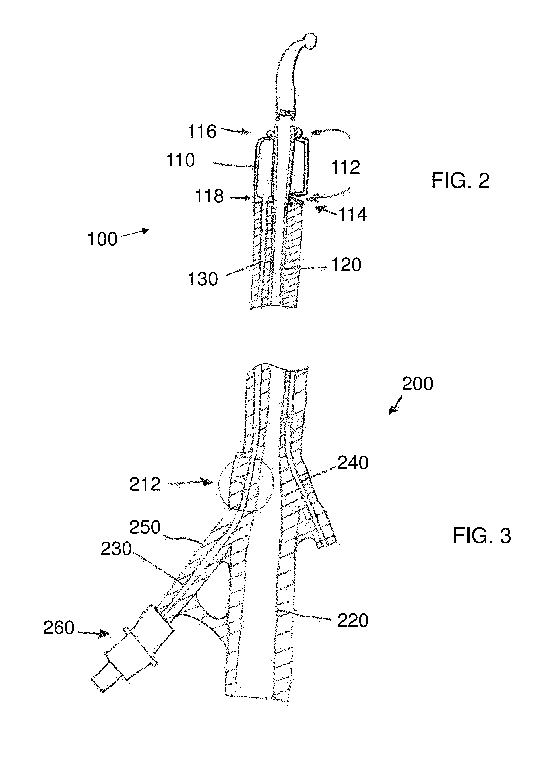 Stretch Valve Balloon Catheter and Methods for Producing and Using Same