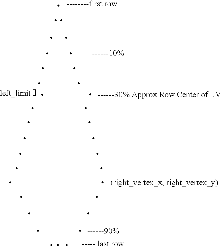 Method for automated analysis of apical four-chamber images of the heart