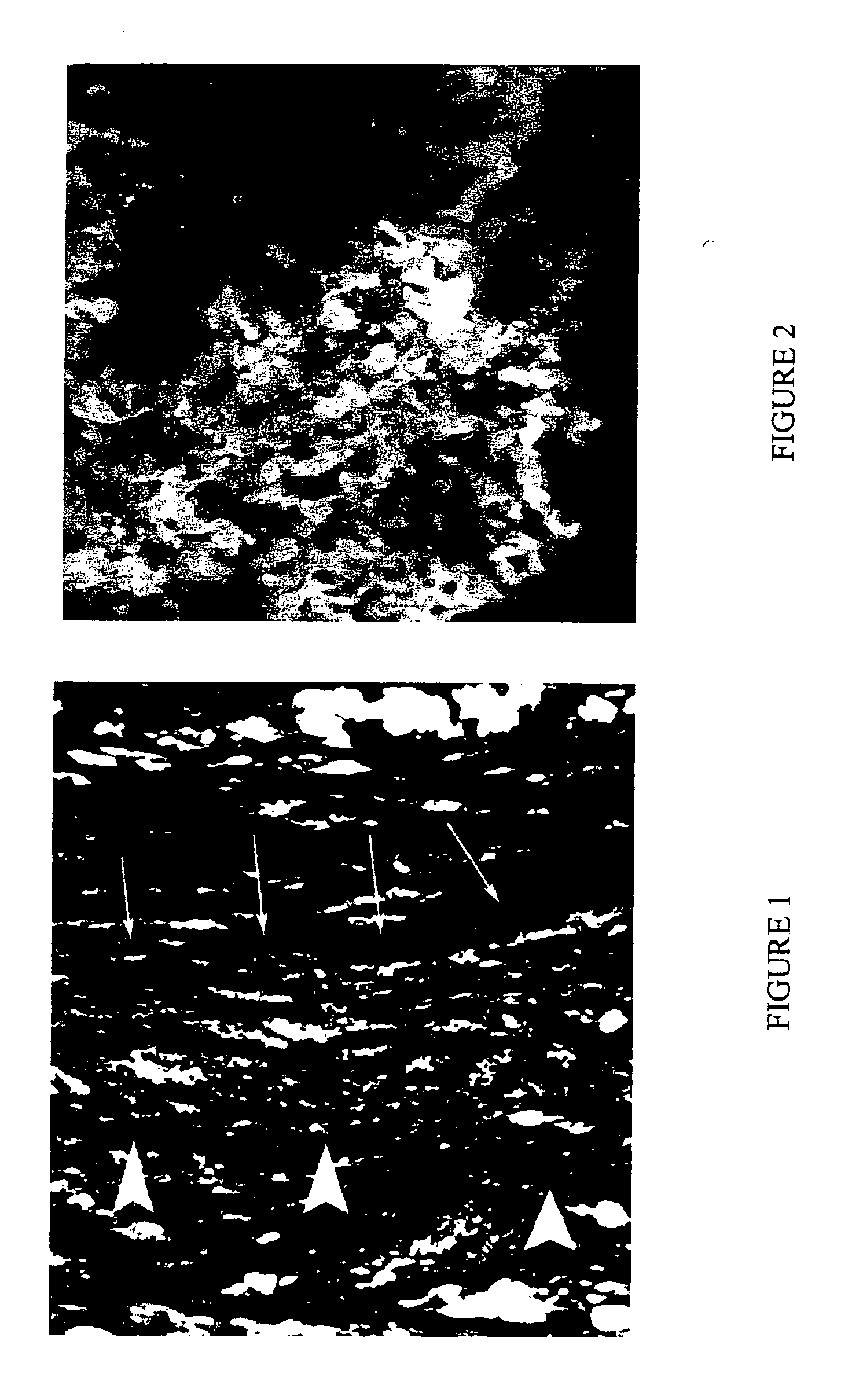 Injectable bioartificial tissue matrix