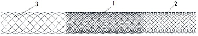 Blood flow guiding dense net stent