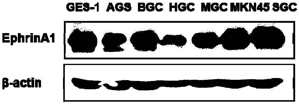 Application of EphrinA1 protein in preparation of drug for inhibiting tumor cell invasion and metastasis
