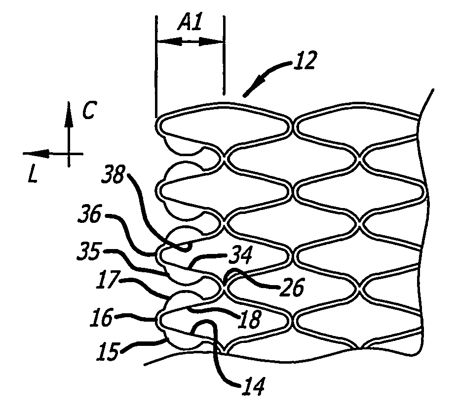 Implantable stent with modified ends