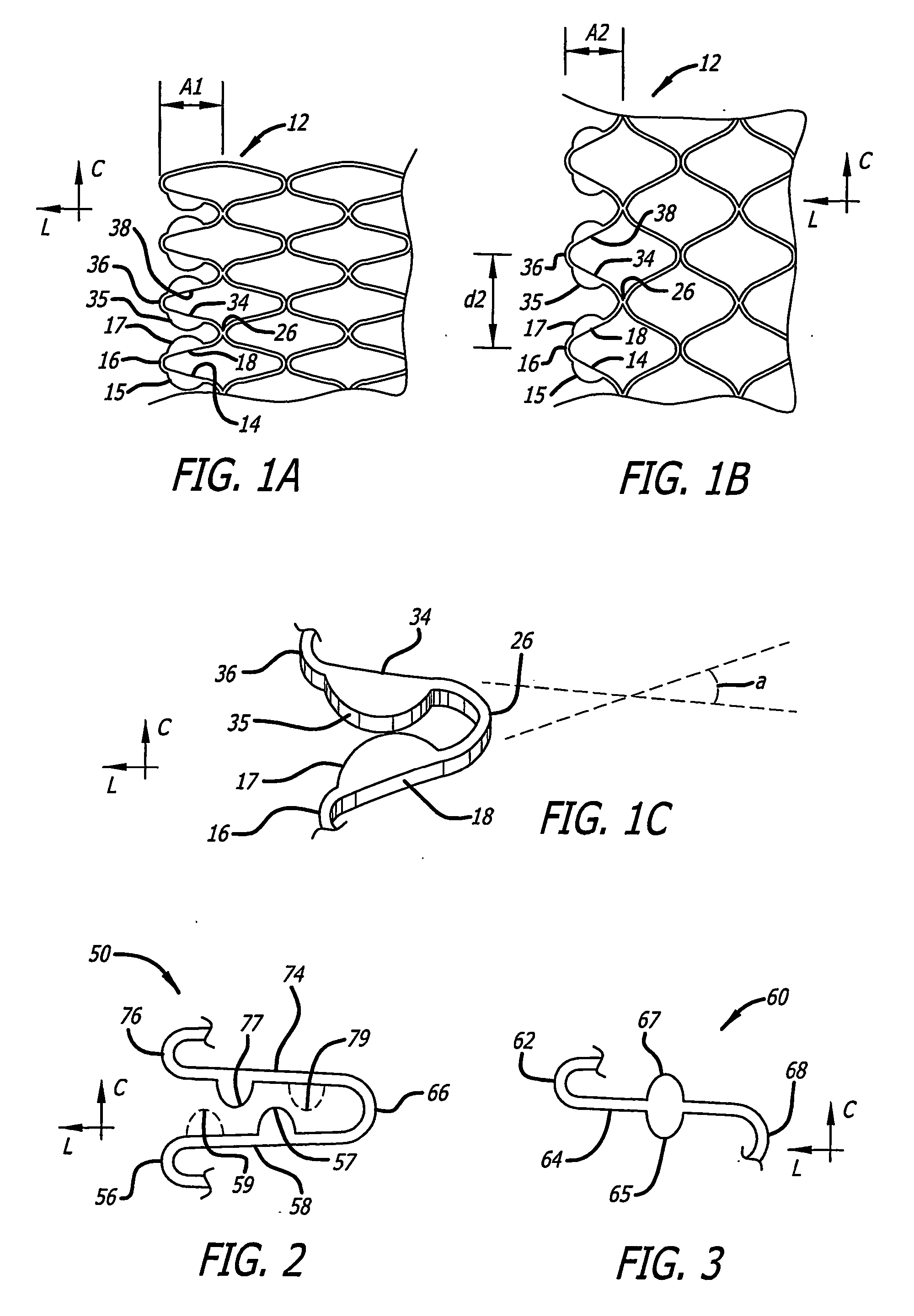 Implantable stent with modified ends