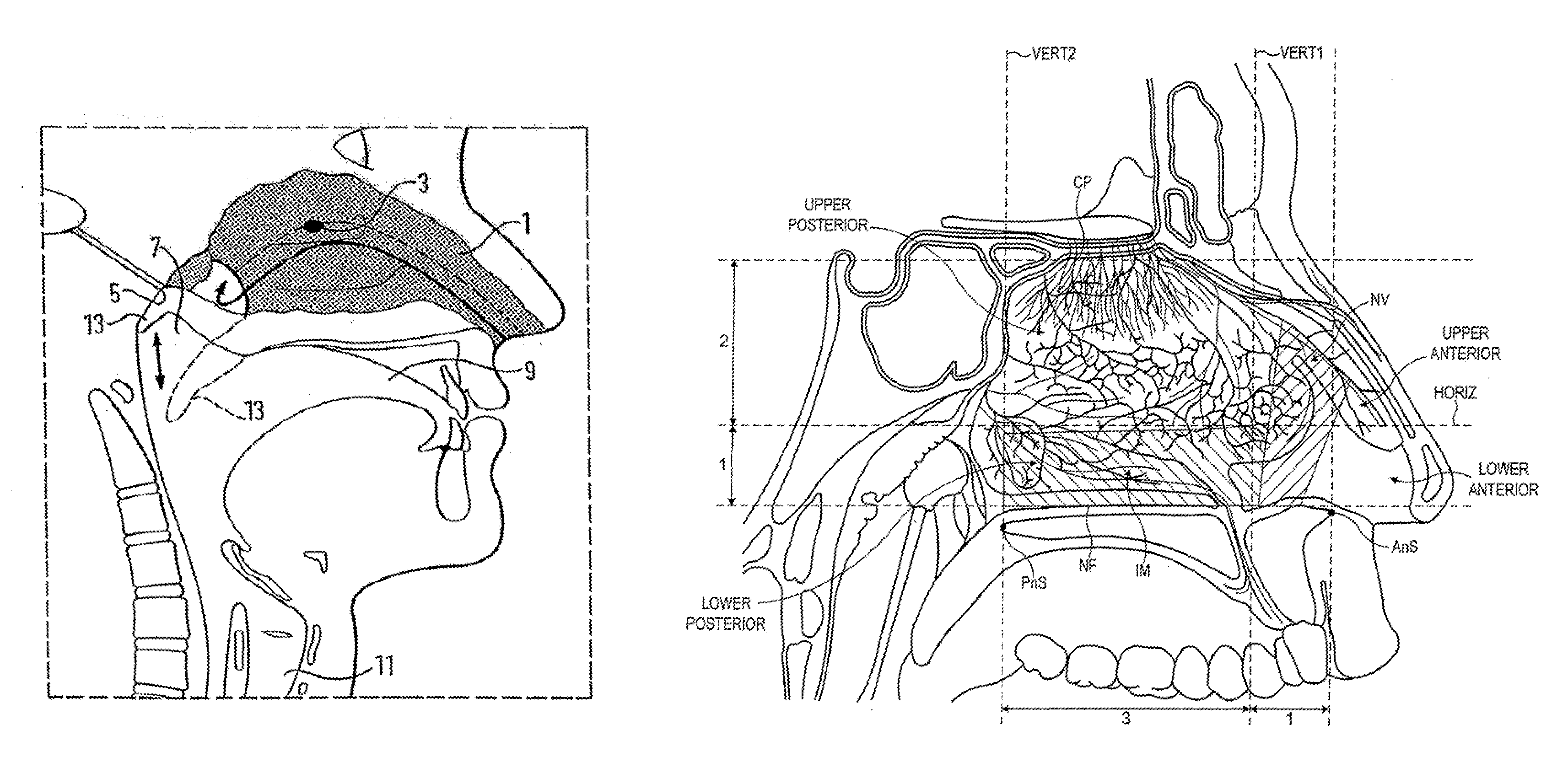 Nasal Administration