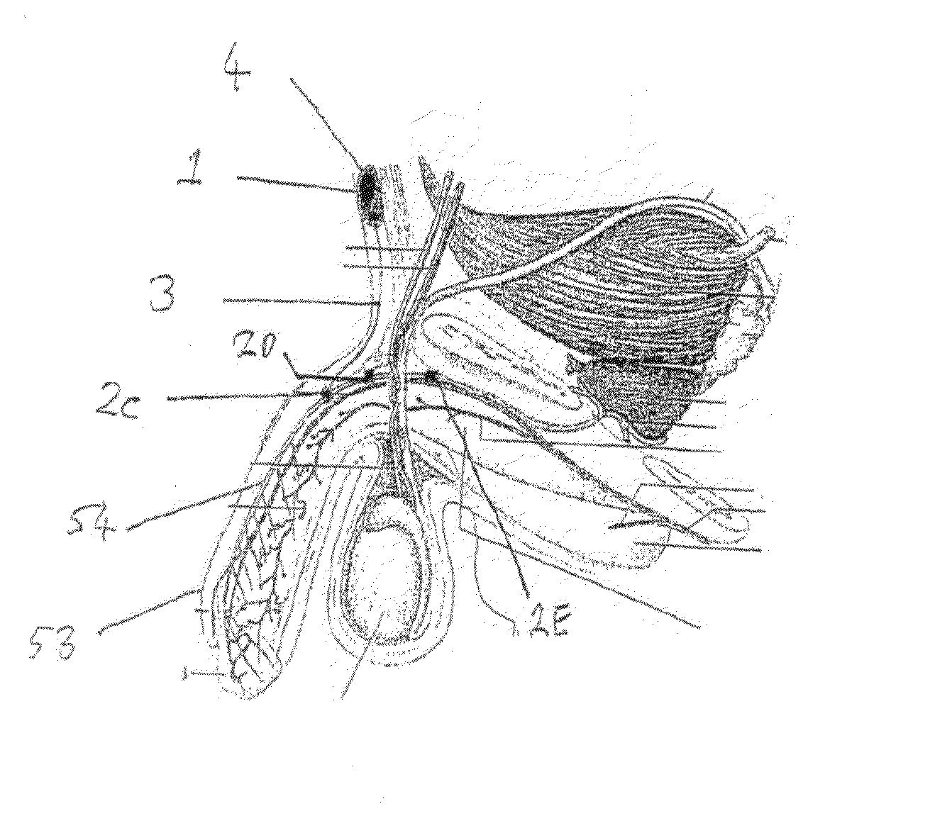 Method and Apparatus for Managing Erectile Dysfunction