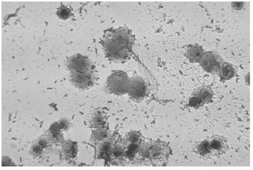 Lactobacillus plantarum RS-09 with high adhesion and applications thereof