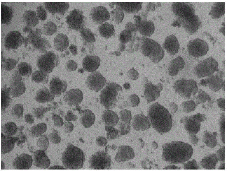 Method for transforming umbilical cord mesenchymal stem cells into islet cells