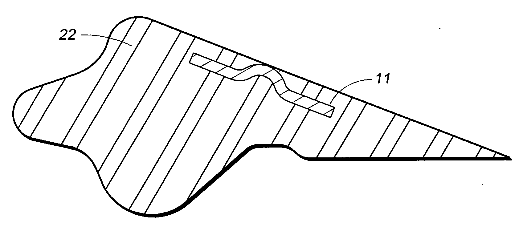 Method for manufacturing a gasket with an encapsulated metal band