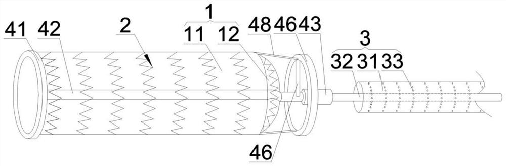 Recyclable covered stent